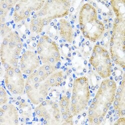 Invitrogen PSTPIP1 Polyclonal Antibody 100 &mu;L; Unconjugated:Antibodies,