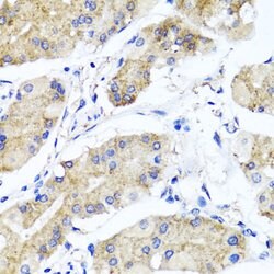 Invitrogen PSTPIP1 Polyclonal Antibody 100 &mu;L; Unconjugated:Antibodies,