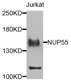 NUP155 Polyclonal Antibody 100 &mu;L | Buy Online | Invitrogen | Fisher Scientific