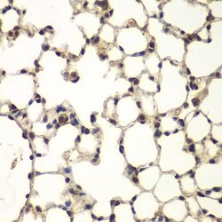 Invitrogen PHF11 Polyclonal Antibody 100 &mu;L | Buy Online | Invitrogen&trade; | Fisher Scientific