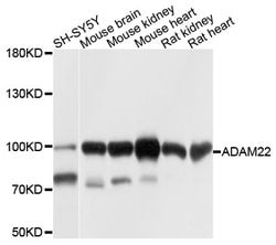 Invitrogen ADAM22 Polyclonal Antibody 100 &mu;L; Unconjugated:Antibodies,