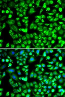 Invitrogen ALKBH4 Polyclonal Antibody 100 &mu;L; Unconjugated:Antibodies,