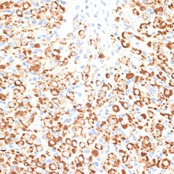 Invitrogen KLHL9 Polyclonal Antibody 100 &mu;L; Unconjugated:Antibodies,