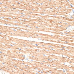 Invitrogen KLHL9 Polyclonal Antibody 100 &mu;L; Unconjugated:Antibodies,
