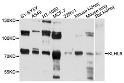 Invitrogen KLHL9 Polyclonal Antibody 100 &mu;L; Unconjugated:Antibodies,