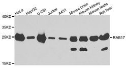 Invitrogen RAB17 Polyclonal Antibody 100 &mu;L; Unconjugated:Antibodies,