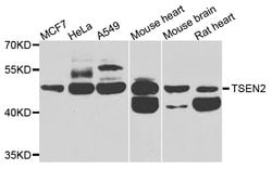 Invitrogen TSEN2 Polyclonal Antibody 100 &mu;L; Unconjugated:Antibodies,