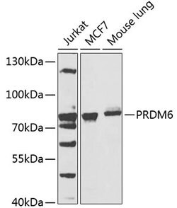 Invitrogen PRDM6 Polyclonal Antibody 100 &mu;L; Unconjugated:Antibodies,