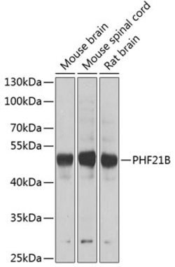 Invitrogen PHF21B Polyclonal Antibody 100 &mu;L; Unconjugated:Antibodies,