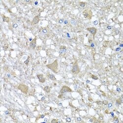 Invitrogen VPS37A Polyclonal Antibody 100 &mu;L; Unconjugated:Antibodies,
