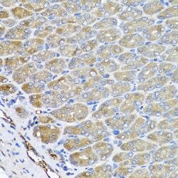 Invitrogen VPS37A Polyclonal Antibody 100 &mu;L; Unconjugated:Antibodies,