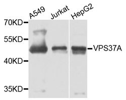 Invitrogen VPS37A Polyclonal Antibody 100 &mu;L; Unconjugated:Antibodies,