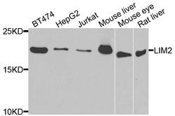 Invitrogen LIM2 Polyclonal Antibody 100 μL; Unconjugated:Antibodies,