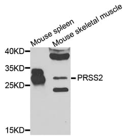 Invitrogen Trypsin 2 Polyclonal Antibody 100 &mu;L; Unconjugated:Antibodies,