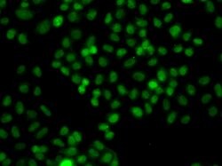 Invitrogen PIP5K1A Polyclonal Antibody 100 &mu;L; Unconjugated:Antibodies,