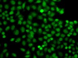 Invitrogen PIP5K1A Polyclonal Antibody 100 &mu;L; Unconjugated:Antibodies,
