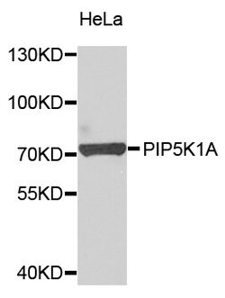 Invitrogen PIP5K1A Polyclonal Antibody 100 &mu;L; Unconjugated:Antibodies,