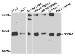 Invitrogen SSNA1 Polyclonal Antibody 100 &mu;L; Unconjugated:Antibodies,