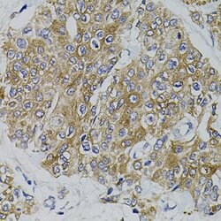Invitrogen ARHGEF11 Polyclonal Antibody 100 &mu;L | Buy Online | Invitrogen&trade; | Fisher Scientific