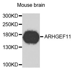 Invitrogen ARHGEF11 Polyclonal Antibody 100 &mu;L | Buy Online | Invitrogen&trade; | Fisher Scientific