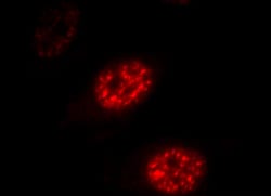 DDX39 Polyclonal Antibody:Antibodies, Polyclonal