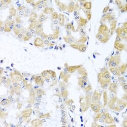 DDX39 Polyclonal Antibody:Antibodies, Polyclonal