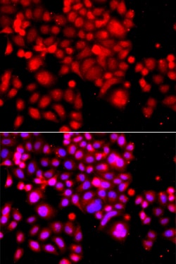 Invitrogen ASCC3 Polyclonal Antibody 100 &mu;L; Unconjugated:Antibodies,