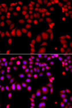 Invitrogen ARHGEF9 Polyclonal Antibody 100 &mu;L | Buy Online | Invitrogen&trade; | Fisher Scientific