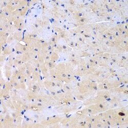 Invitrogen ARHGEF9 Polyclonal Antibody 100 &mu;L | Buy Online | Invitrogen&trade; | Fisher Scientific