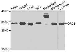 Invitrogen ORC6 Polyclonal Antibody 100 &mu;L; Unconjugated:Antibodies,