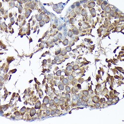 Invitrogen MTHFD1L Polyclonal Antibody 100 &mu;L | Buy Online | Invitrogen&trade; | Fisher Scientific