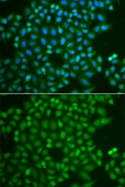 Invitrogen UCH37 Polyclonal Antibody 100 &mu;L; Unconjugated:Antibodies,