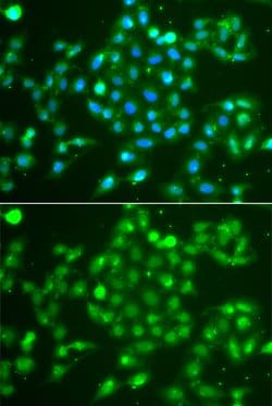 Invitrogen UCH37 Polyclonal Antibody 100 &mu;L; Unconjugated:Antibodies,