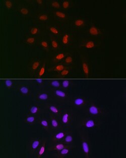 Invitrogen TDP1 Polyclonal Antibody 100 &mu;L; Unconjugated:Antibodies,