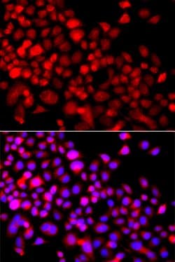 Invitrogen CALCOCO1 Polyclonal Antibody 100 &mu;L; Unconjugated:Antibodies,