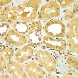 Invitrogen CALCOCO1 Polyclonal Antibody 100 &mu;L; Unconjugated:Antibodies,
