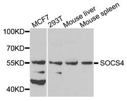 Invitrogen SOCS4 Polyclonal Antibody 100 &mu;L; Unconjugated:Antibodies,