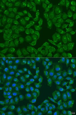 Invitrogen MSRB3 Polyclonal Antibody 100 &mu;L; Unconjugated:Antibodies,