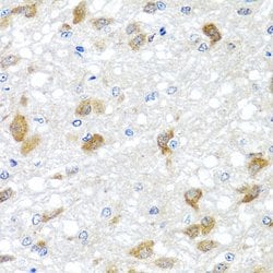 PIP4K2B Polyclonal Antibody:Antibodies, Polyclonal