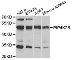 PIP4K2B Polyclonal Antibody:Antibodies, Polyclonal