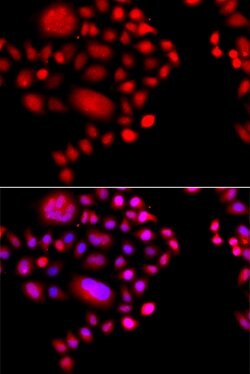 Invitrogen POLR1D Polyclonal Antibody 100 &mu;L; Unconjugated:Antibodies,