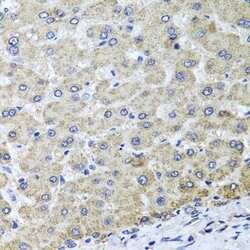 Invitrogen OSGEPL1 Polyclonal Antibody 100 &mu;L; Unconjugated:Antibodies,