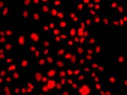 Invitrogen PRICKLE2 Polyclonal Antibody 100 &mu;L; Unconjugated:Antibodies,