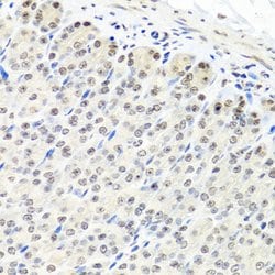Invitrogen CNOT8 Polyclonal Antibody 100 &mu;L; Unconjugated:Antibodies,