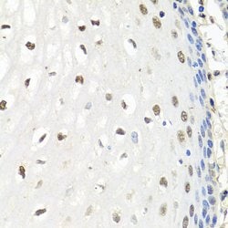 Invitrogen CNOT8 Polyclonal Antibody 100 &mu;L; Unconjugated:Antibodies,