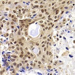 Invitrogen PHF19 Polyclonal Antibody 100 &mu;L; Unconjugated:Antibodies,
