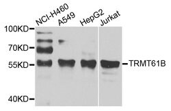 Invitrogen TRMT61B Polyclonal Antibody 100 &mu;L; Unconjugated:Antibodies,