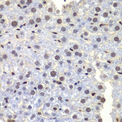 Invitrogen LHX4 Polyclonal Antibody 100 &mu;L; Unconjugated:Antibodies,