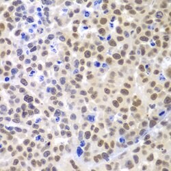 Invitrogen LHX4 Polyclonal Antibody 100 &mu;L; Unconjugated:Antibodies,