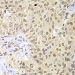 Invitrogen LHX4 Polyclonal Antibody 100 &mu;L; Unconjugated:Antibodies,